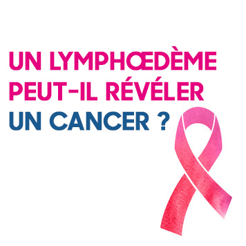 Un lymphœdème peut-il révéler un cancer ?