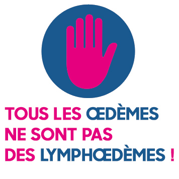 Tous les œdèmes ne sont pas des lymphœdèmes !